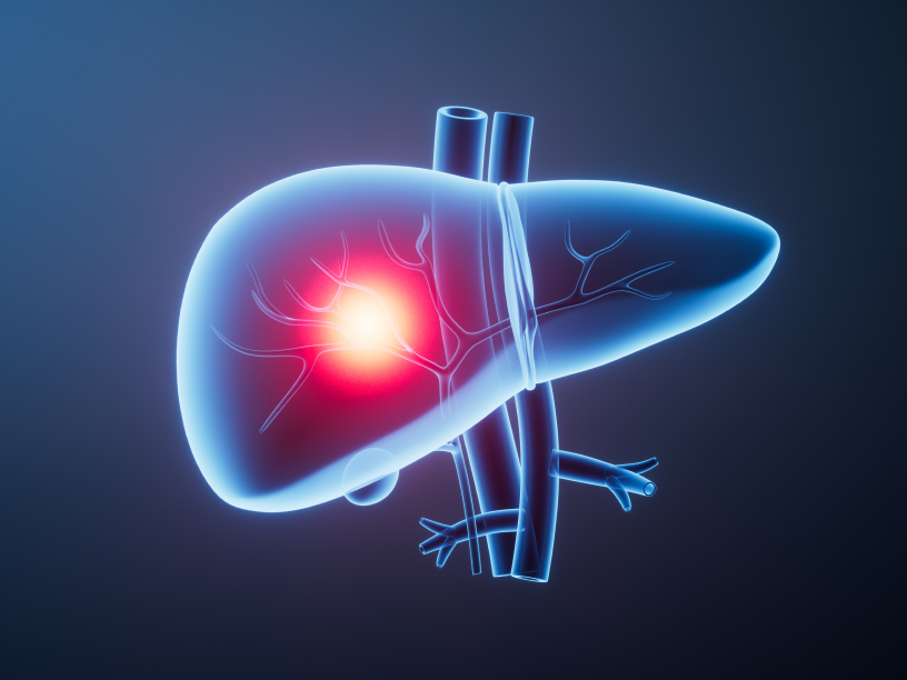 Liver Segmentation